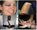 Wii-related injury roundup -- Engadget