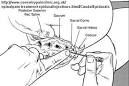 Caudal Block
