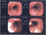 Healing Cancer Naturally: Testimonials