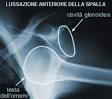 <b>Lussazione</b> della spalla