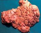 Bovine Tuberculosis « Disease Images « CFSPH