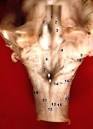File:Human caudal brainstem posterior view description.JPG ...