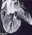 Feline Hypertrophic Cardiomyopathy