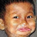 這名5歲男童森索皮（Seng Sophea，小名Tot）2005年7月在柬埔寨一個小鄉村出世，他 ... - 39d18c5bbb49e5bfed3b2054c06d1778