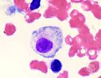 Reactive <b>Histiocytes</b> in the