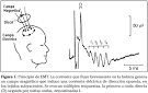 Anales del Sistema Sanitario de Navarra - <b>Estimulación magnética</b>