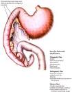 Exocrine Pancreatic Insufficiency (EPI) | Hill's Nutrition