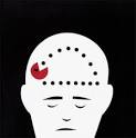 hypnosis57: Mental Health and Dissociative Amnesia