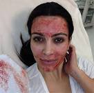 Kim Kardashian did what to her