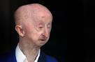 ALAN BARNES: ��50,000 raised for disabled attack victim in just 48.
