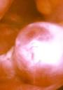 Superfetation: Pregnant while already pregnant | Guest Blog ...