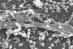 Biofilm - Wikipedia, the free encyclopedia