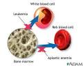 Immunodeficiency Disorders