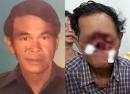 ลุง70ไฝข้างแก้มแตกหน้ายุบตาหลุดดั้งหาย | ข่าว ข่าวรายวัน ข่าววัน ...