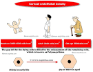 Anatomy of cornea