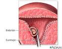 CARACTERISTICAS DEL <b>ABORTO</b>