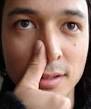 Nose bleeds - How to stop a nose bleed fast