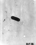 Listeria monocytogenes - Wikipedia, the free encyclopedia