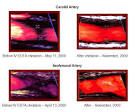 Ultrasound before and after improvements with chelation therapy