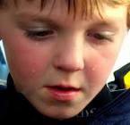 File:A child sad that his hot
