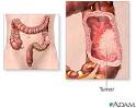 The <b>colon</b> absorbs water from