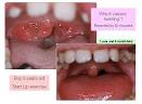 Lip Trainer Patakara ::
