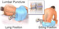 How is <b>viral meningitis</b>