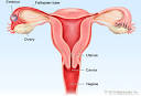 Picture of <b>Tubal Pregnancy</b>