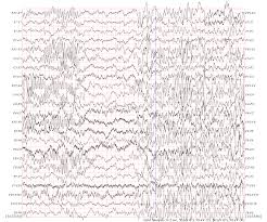 images?q=tbn:ANd9GcRohNLtvJqTOwv7neEao59XpkXSBc-KzgAABHreCOQPeucxYVpy