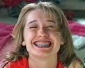 various makeups | fake teeth &amp; dental braces | Allison Mack in 'My ...