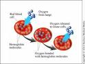 Another common type of <b>anemia</b>
