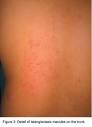 Anais Brasileiros de Dermatologia - Case for diagnosis