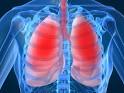 Respitory Disease