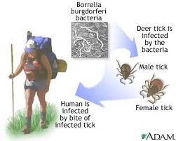 lyme