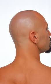Homem careca pode ter mais doen&ccedil;as do cora&ccedil;&atilde;o, segundo estudo ...