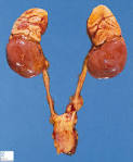 Adrenal gland