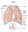 Bronchiectasis - Modern Medical Guide