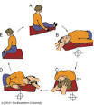 BPPV -- BENIGN PAROXYSMAL POSITIONAL VERTIGO
