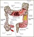 Colon cleansing,colon hydrotherapy,colonics,MA,RI,colonic ...
