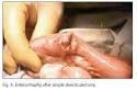 Revista Española de Enfermedades Digestivas - Patología quirúrgica ...
