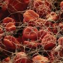 <b>Fibrin</b> Clot.
