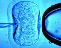 In Vitro Fertilization | Being Pregnant