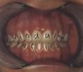 Fat Les - Vindaloo - single info and formats