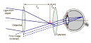 Refractive Telescopes