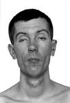 <b>Kearns</b>-<b>Sayre syndrome</b> - meddic