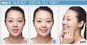 소근: 운동 입을 옆으로 늘이는