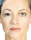 the effects of ageing?