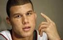 Is Blake Griffin going bald?