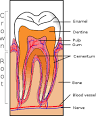 Gingiva - Wikipedia, the free encyclopedia