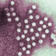 NOROVIRUS | Flickr - Photo Sharing!